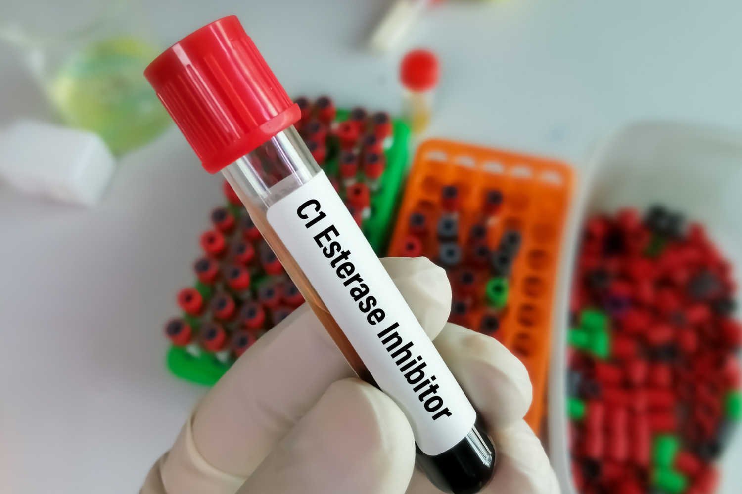 C1 inhibitor injection