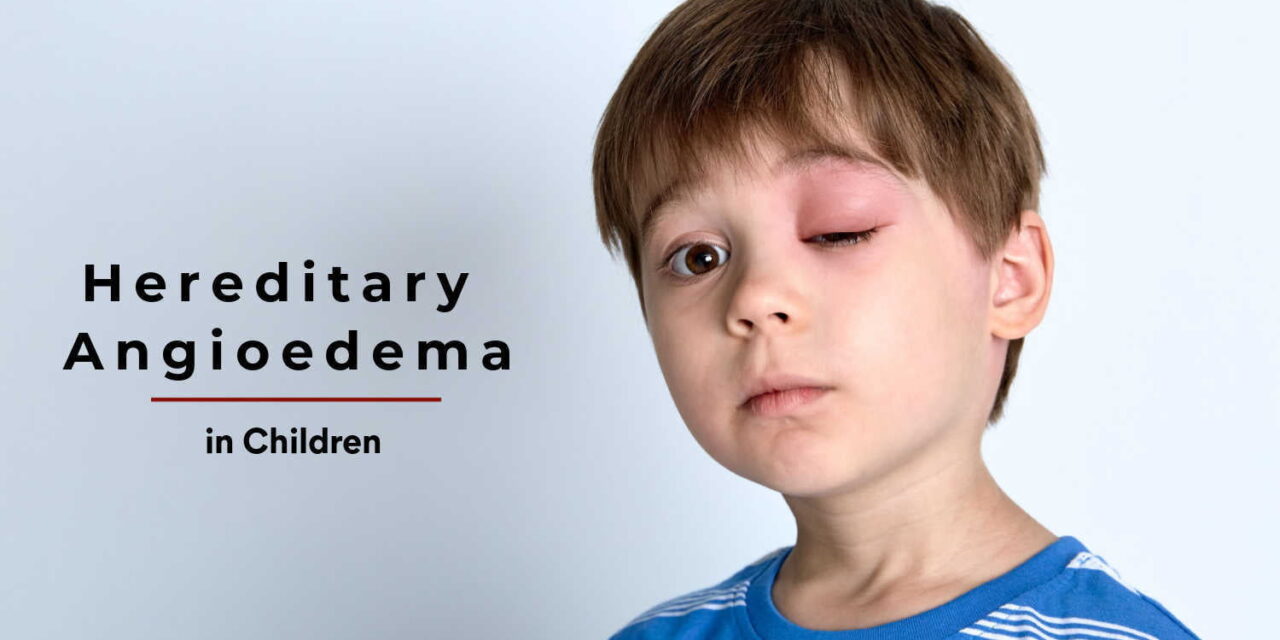 Hereditary Angioedema in Children – Types, Causes and Symptoms