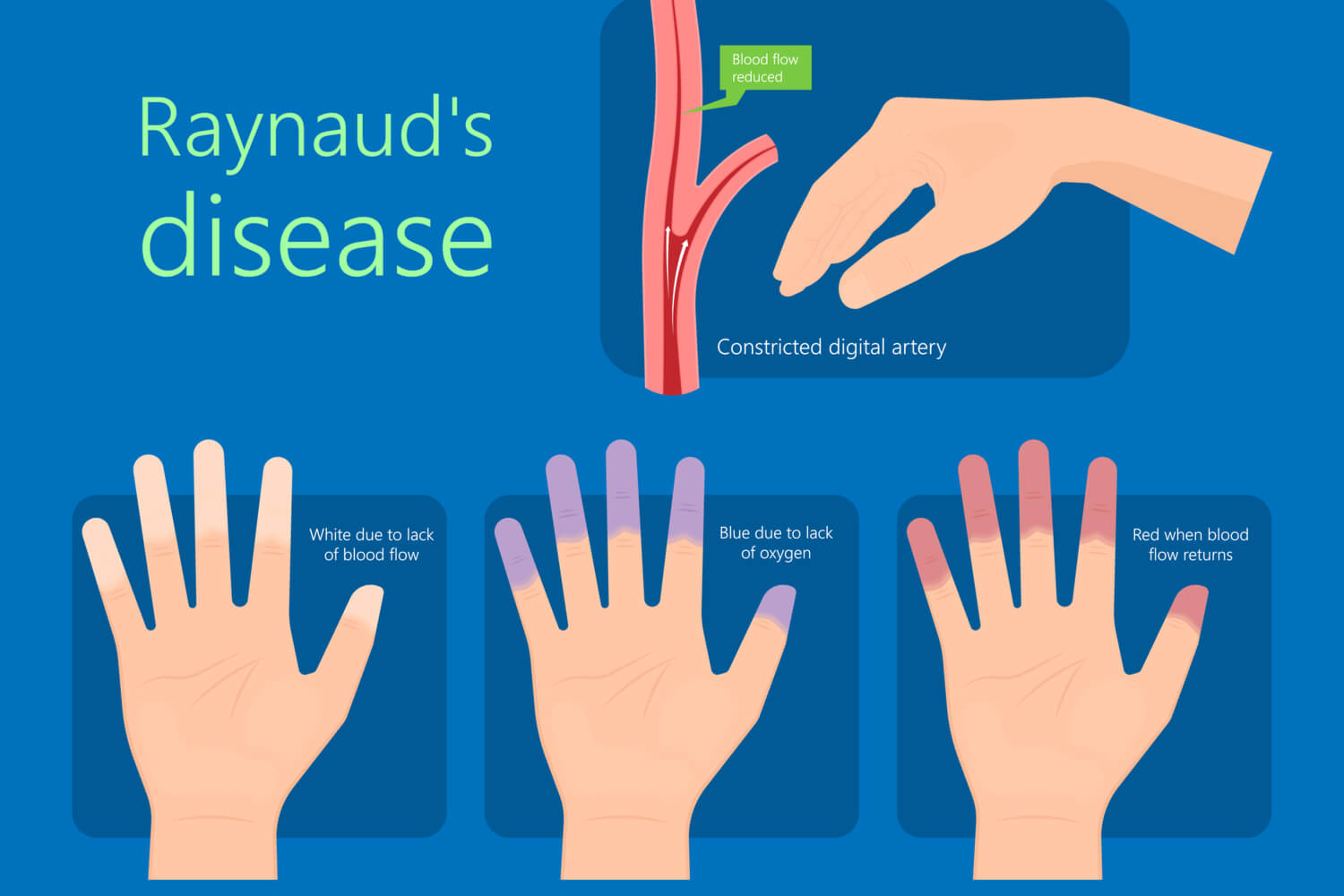 Common Symptoms of Pediatric Scleroderma