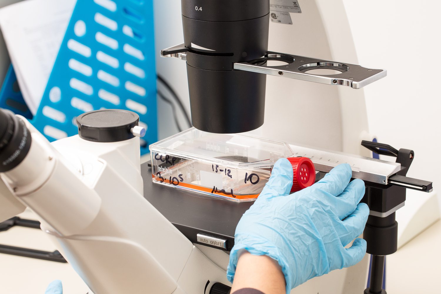 Conditions Treatable by Gene Therapy