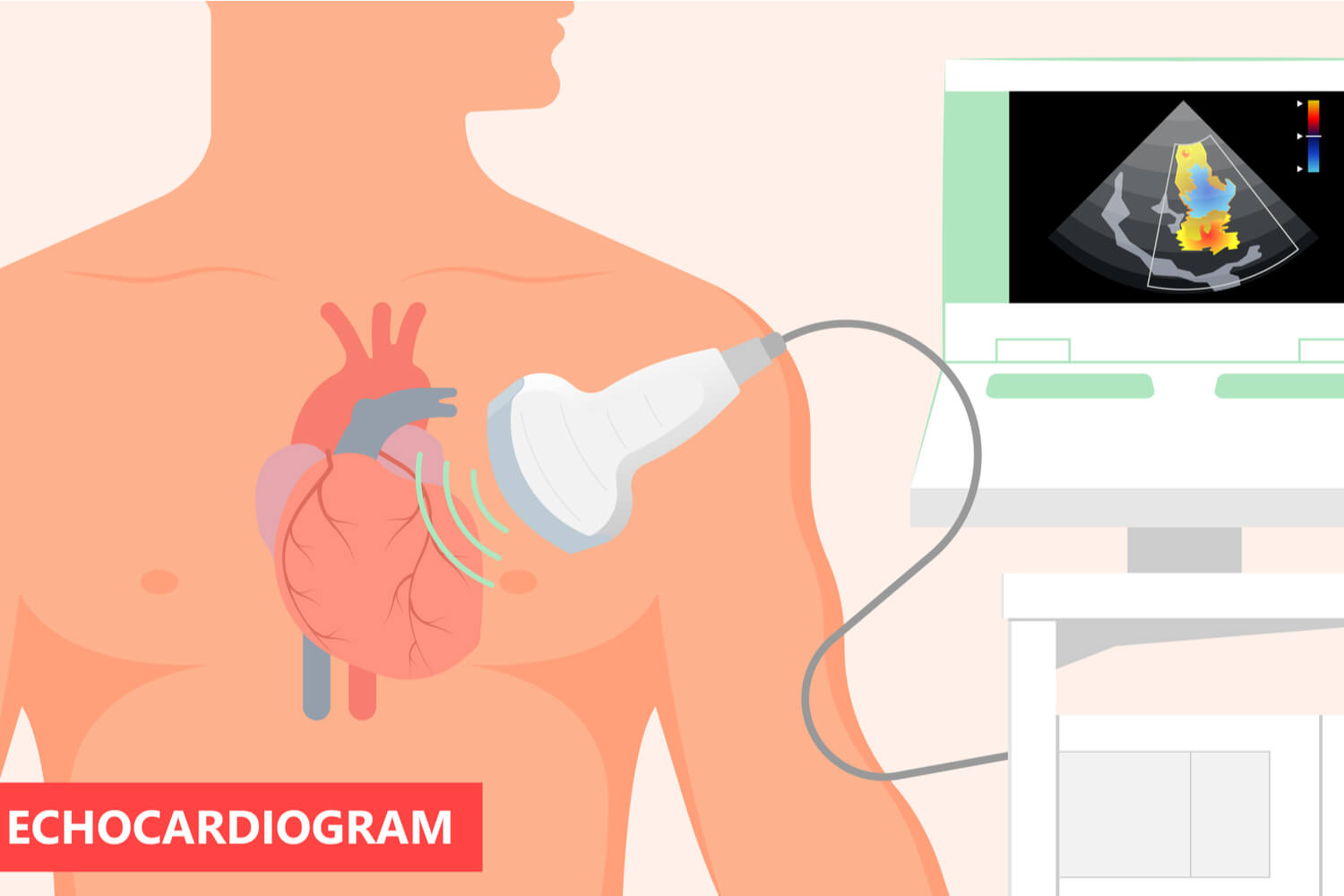 Echocardiogram