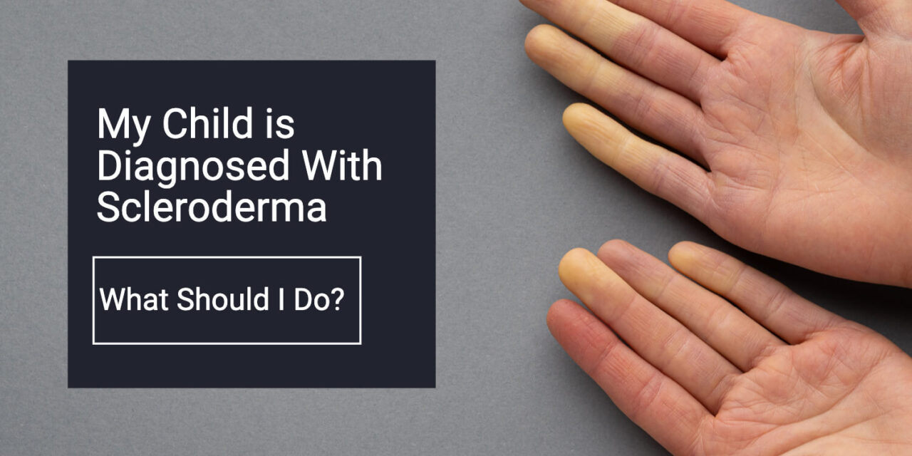 Scleroderma in Children: What Parents Should Do