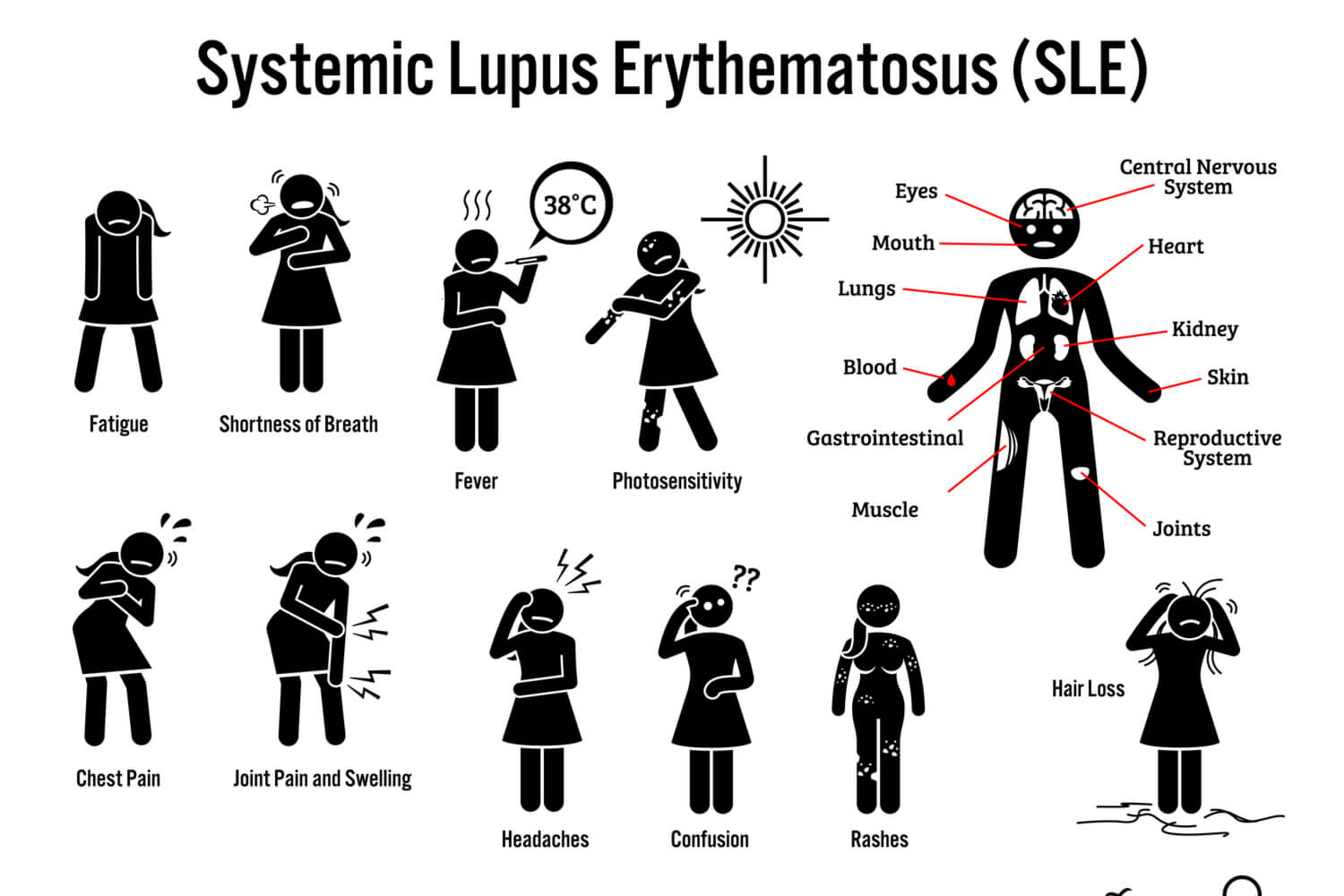 Systemic Lupus Erythematosus-symptoms