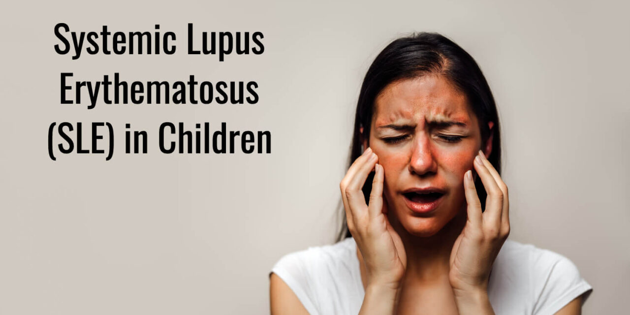 Systemic Lupus Erythematosus(SLE) in Children